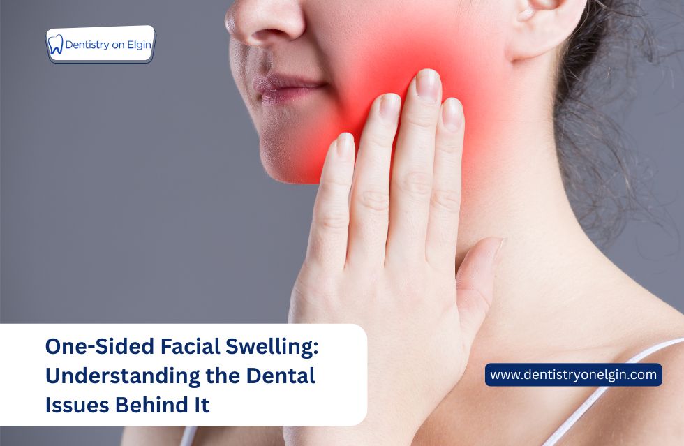 One-Sided Facial Swelling: Understanding the Dental Issues Behind It
